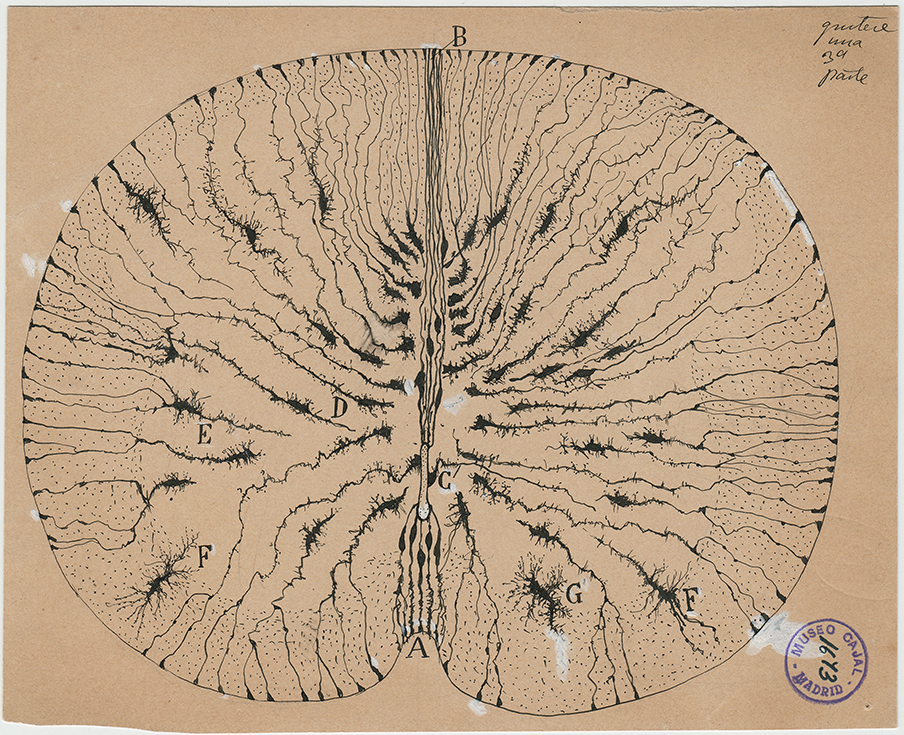 The brain in focus